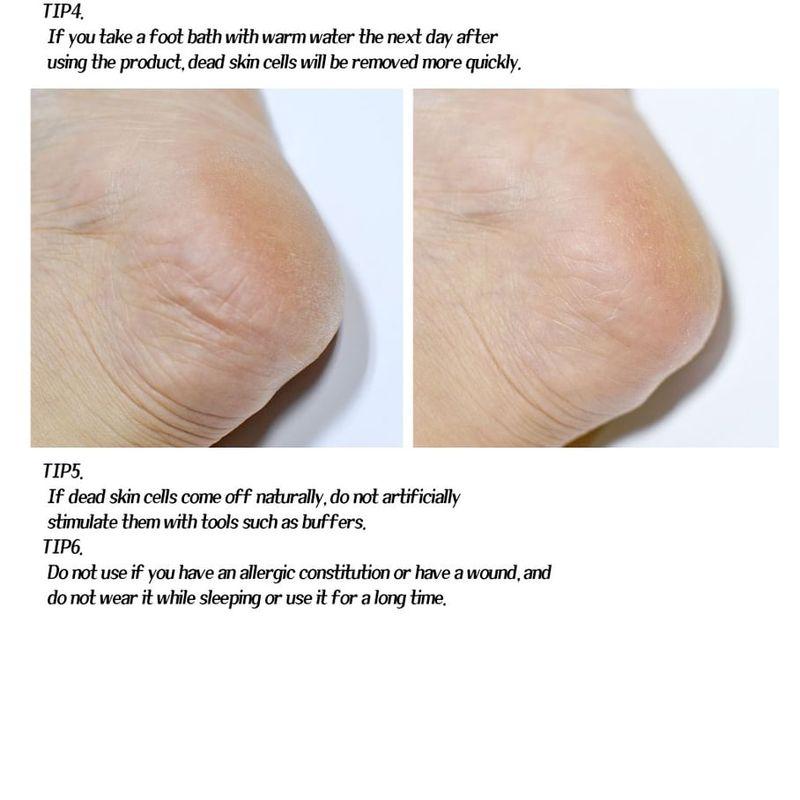 LEBELAGE - Vitamin Peeling Foot Pack