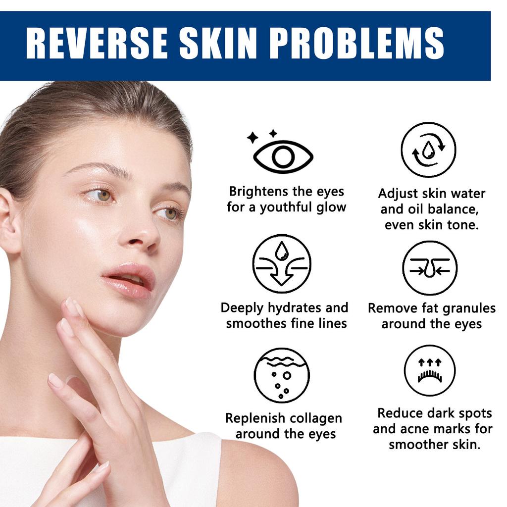 EELHOE Hyaluronic Acid Whitening Eye Cream Anti Dark Circles Eye Bags Wrinkle Removal Skin Serum Brighten Moisturizer Eyes Beauty Health