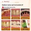 MAIRULSY Anti-Tartar & Stain Removal Toothpaste