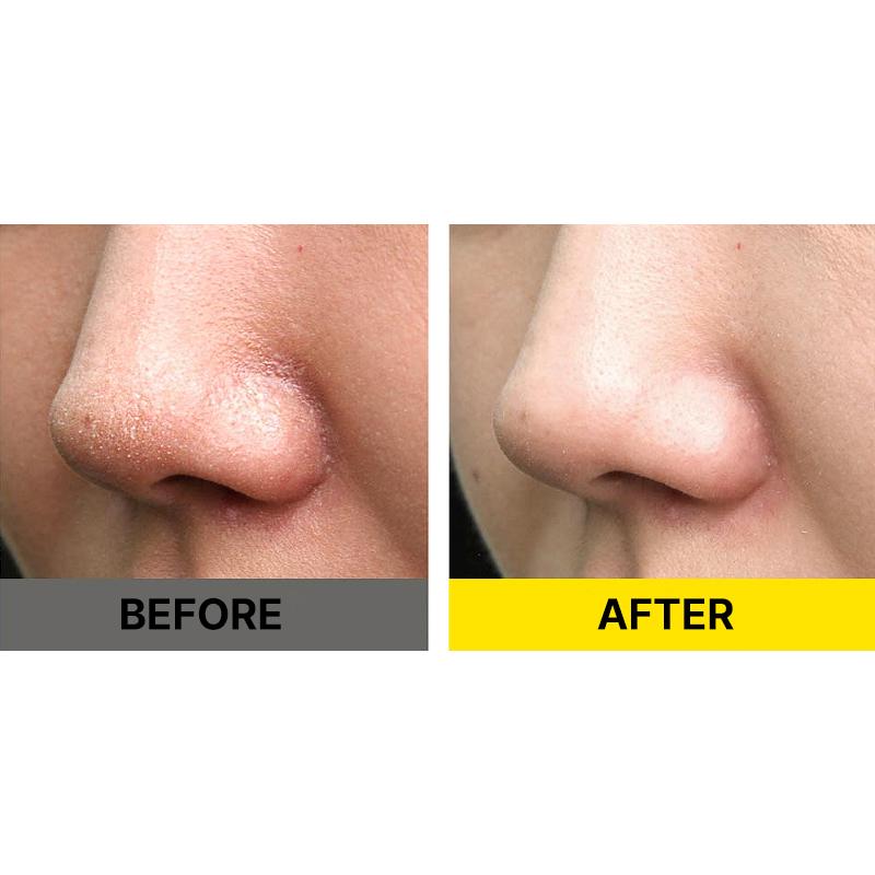 SIDMOOL PDRN Spicule Peeling Gel 80ml