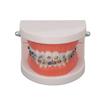 Dental Typodont Teeth Model with Orthodontic Metal Bracket for Dentist Teaching Research Dental Laboratory