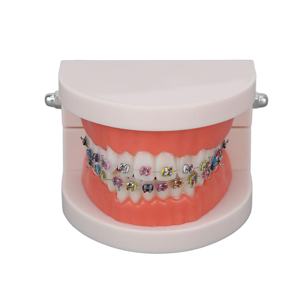 Dental Typodont Teeth Model with Orthodontic Metal Bracket for Dentist Teaching Research Dental Laboratory