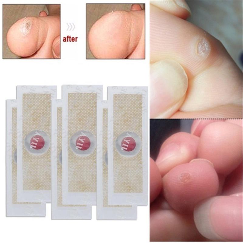 

Ноги кукурузы Убийца мозоли подошвенные бородавки Торн Боль Помощи Toe Защитник