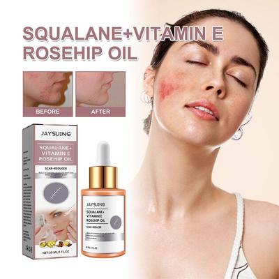 Scar Surgery Scar Dilution Cream To Burn The Impression Scar Dilution Surgery Beard Cream Remov I3U7