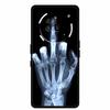 For Nothing Phone 3A Pro Case 3 A Pro Phone Cover Wolf Black Silicone Soft Coque For Nothing Phone3A Pro Back Cover Case 3APro