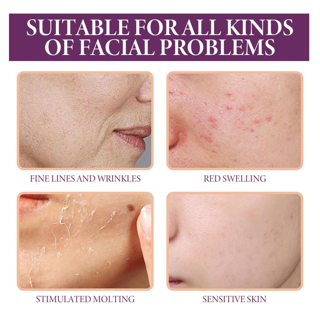 Oceaura 50ml Glycolic Acid Repair Essence For Sensitive Skin Smooth Radiant Complexion