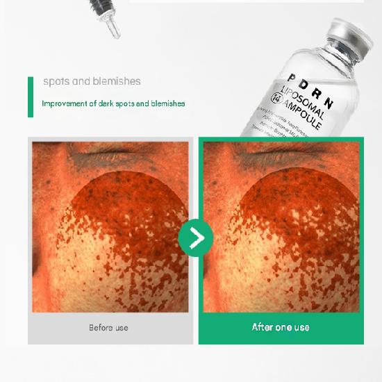 LIRI PDRN Liposome 14 Ampoule 50ml