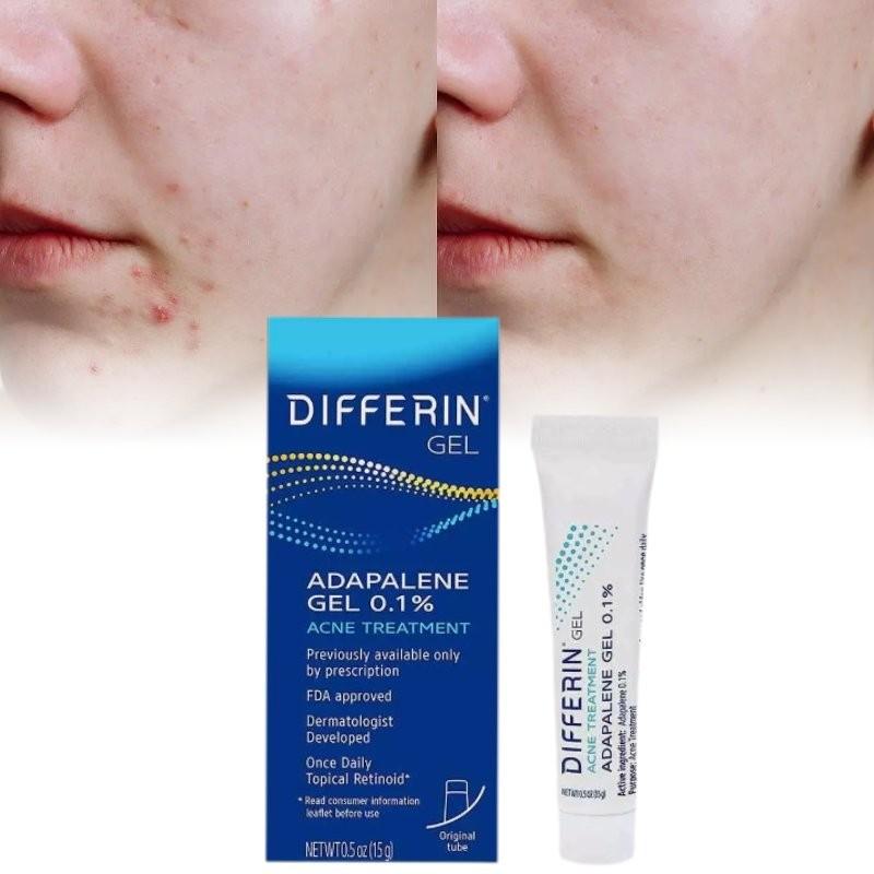 Differin Gel Traitement Acné Gel Rétinoïde Pour Peau Claire Radieuse 15g