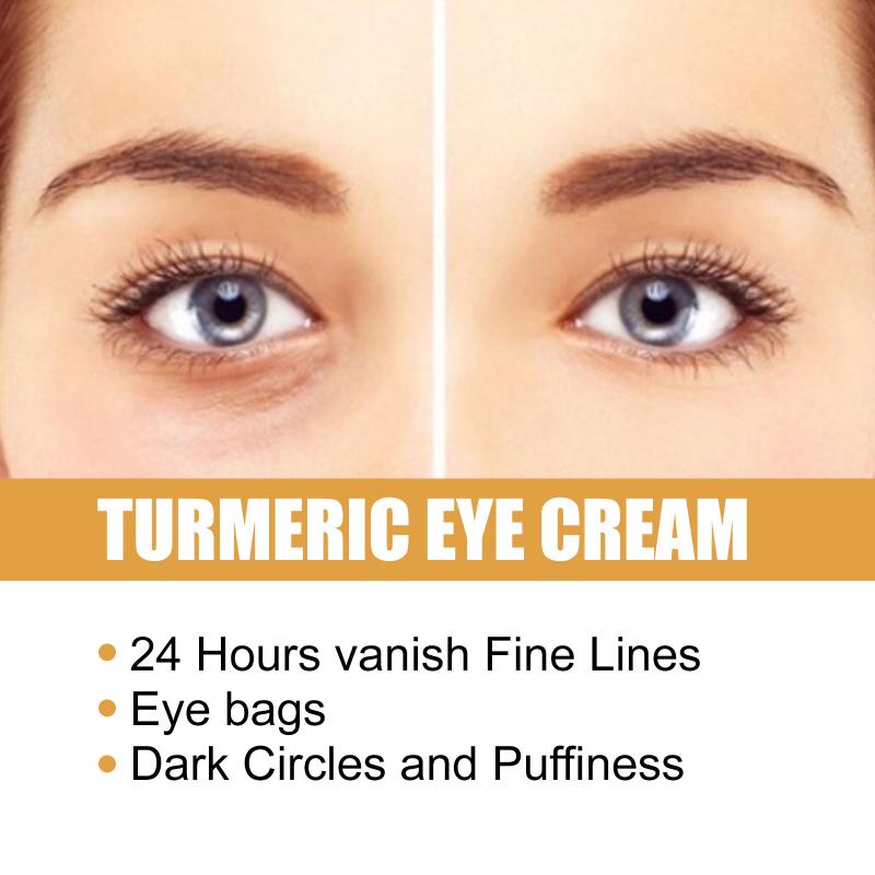 

Eelhoe Turmeric Eye Cream Reduces Fine Lines Around The Corners Of The Eyes, Dark Circles, Eye Bags, Tightens The Eye Area 1pcs