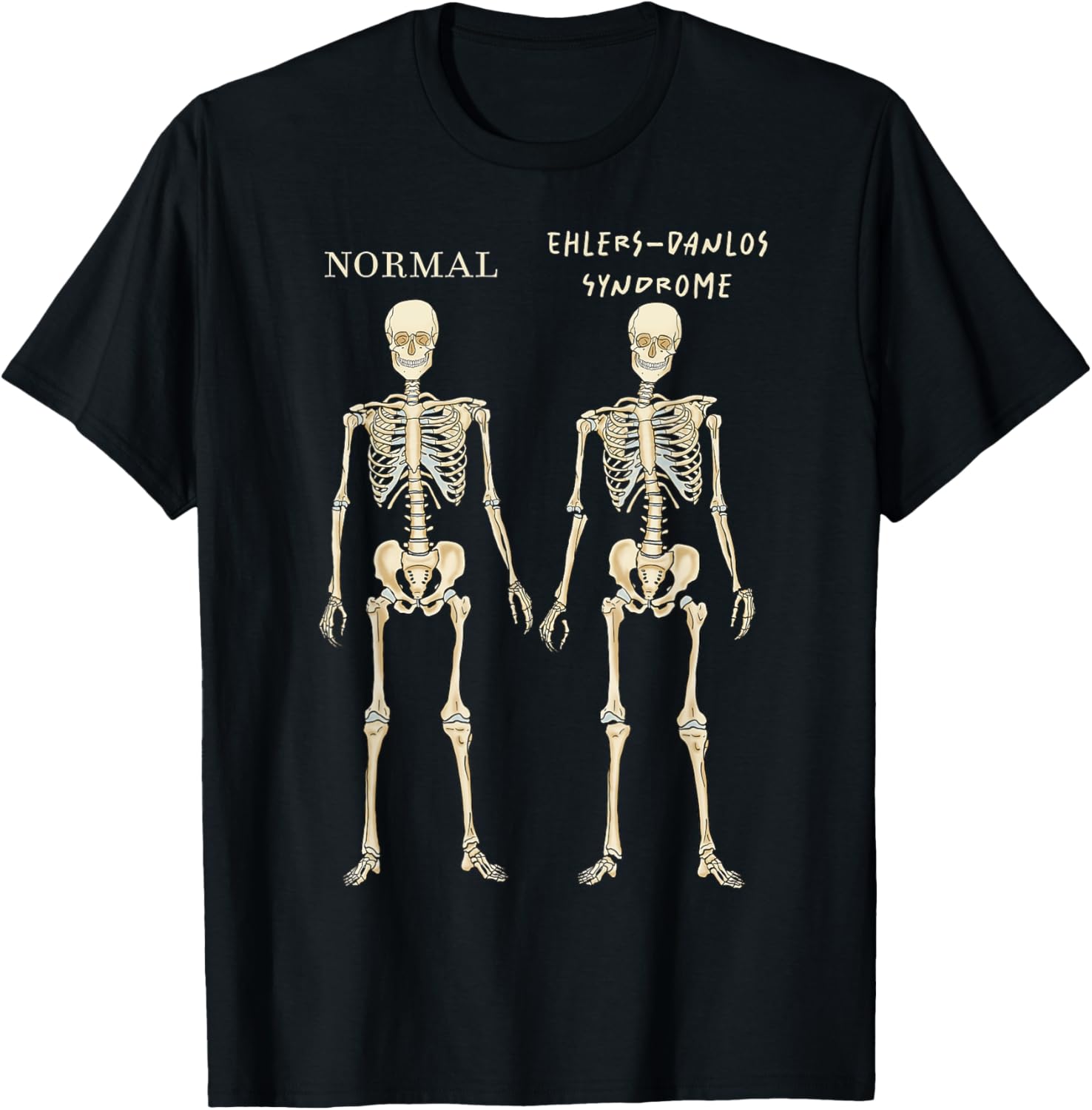 Ehlers Danlos Syndrome Skeletons Zebra Awareness Spoonie T-Shirt S разноцветный
