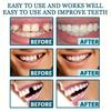 White Dentures - Adjustable Upper and Lower Dentures for Men and Women, Comfortable Fit and Natural Smile