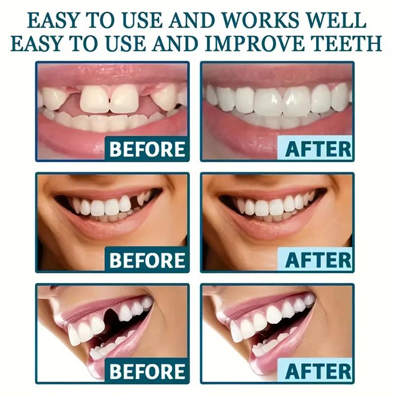 White Dentures - Adjustable Upper and Lower Dentures for Men and Women, Comfortable Fit and Natural Smile