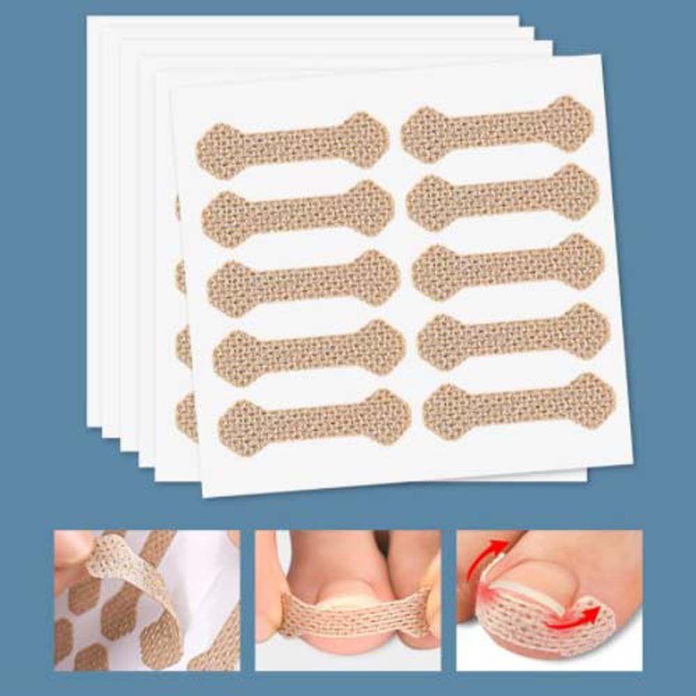 10 adet/takım Ayak Tırnağı Düzeltme Aracı Tırnak Tedavisi Elastik Yama Brace Pedikür Aracı Tırnak Düzeltme Çıkartmalar