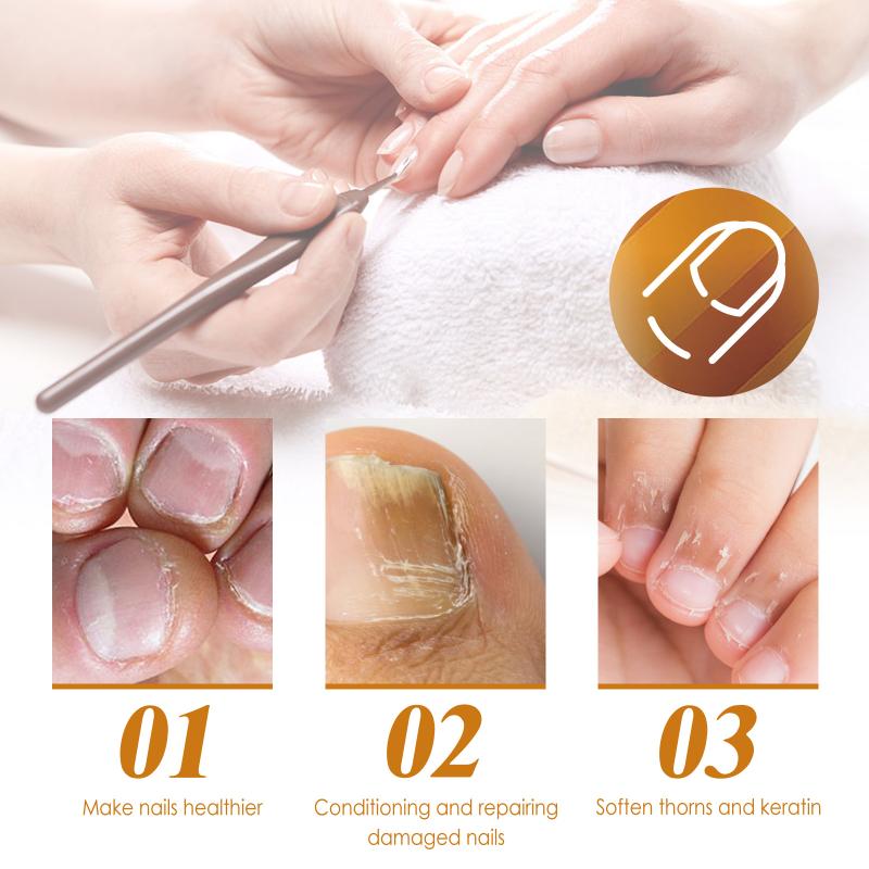30Ml Nail Cuticle Remover Gel  15 Seconds Cuticle Softener Gel Moisturizing For Damaged Skin And Thin Nails Repair Gel