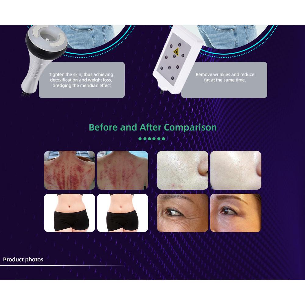 6-in-1 40kHz Cavitation 0.5MHz RF Vacuum 110V-220V Body Contouring Touchscreen Air Cooled Easy Operation