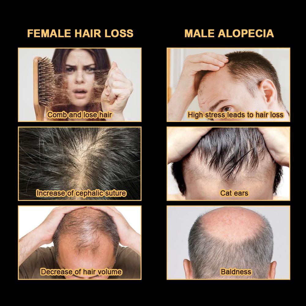 30ml Hair Repair Essence, Anti-hair Loss Nourishing Liquid, Long Hair Nourishing Hairline, Multiflorum Multiflorum Hair Nourishing Essence