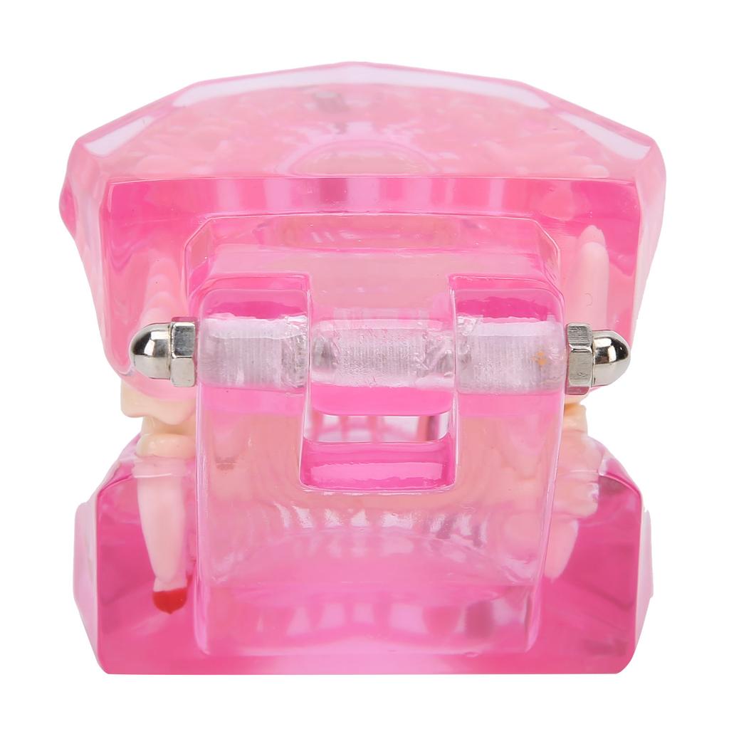 Transparent Adult Teeth Model Pathological Repair Studying Dental Teaching Tools