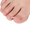 10 Uds. Clip para alisar las uñas de los pies encarnadas, corrección de uñas, parche adhesivo