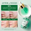 ANAiRUi 1.5% Salicylic Acid Tea Tree Face Oil, Soothing Purifying Facial Oil for Acne Prone Skin 30ml