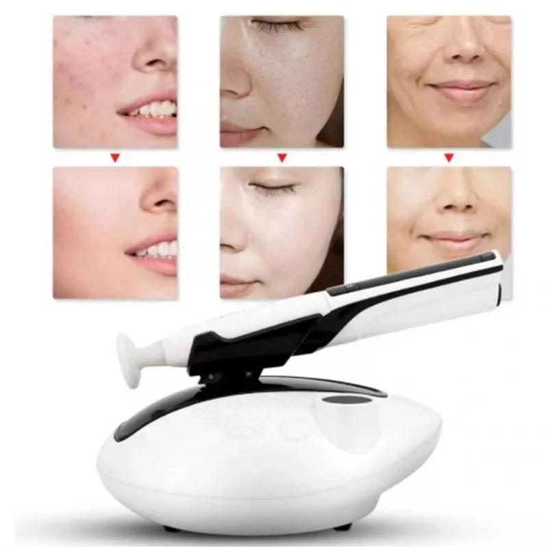 Rivitalizza la Tua Pelle Con la Penna al Plasma Ozono Per il Trattamento dell'Acne, Ringiovanimento Cutaneo, Riduzione delle Cicatrici, Rassodamento della Pelle