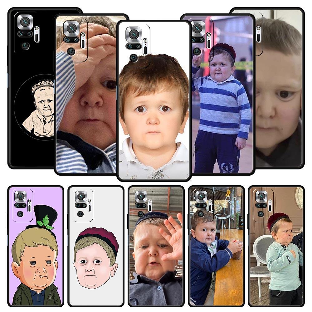 Funny Babaite Hasbulla Phone Case For Xiaomi Redmi Note 15 14 13 12 5G 11 10 Pro Plus 4G 9S 14C 13C 12C 10C Soft TPU Cover