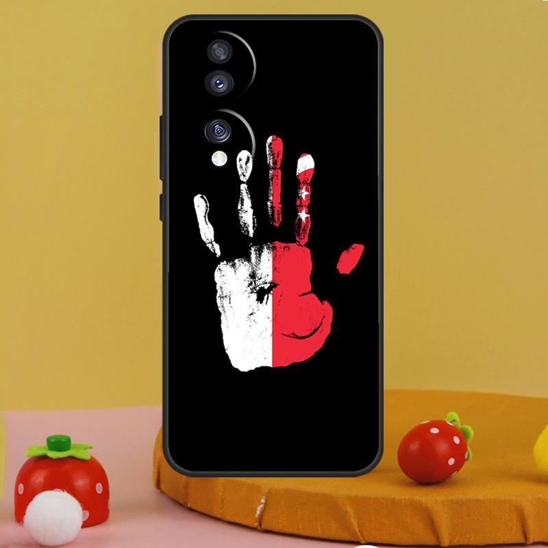 Singapore Flag Case For Honor 200 Pro X9c X9a X8a X7a X6a X7 X8 X9 X8b X9b 50 70 90 Magic 5 6 Lite Cover
