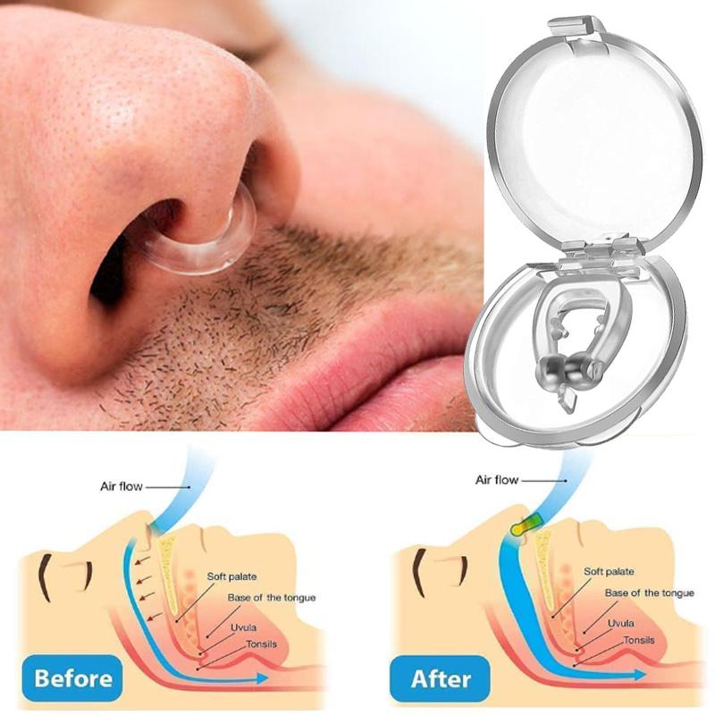 Anti-snoring anti-snoring artifact for men and women to prevent snoring snoring sleep anti-snoring device respiratory aligner