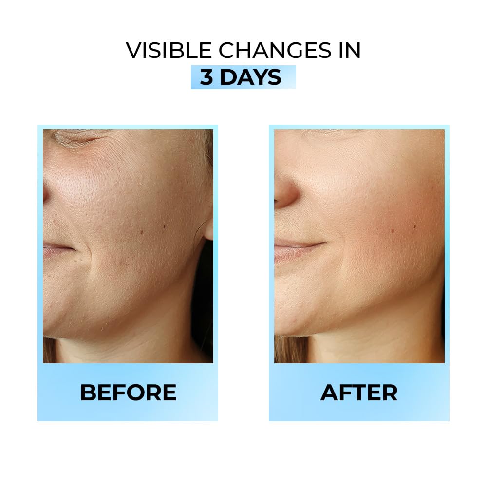 Streax Serum Hydrate & Shine Face Serum 30ml for Brightening Instant Glow and 48Hr Hydration for All Skin Types