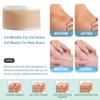 For Keloid, C-Section, Surgery, Burn, Acne Waterproof 1 Roll 150/300cm Silicone Scar Sheets Medical Grade, Reusable Scar Tape
