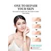 1PC After Burn Fading Skin Ointment