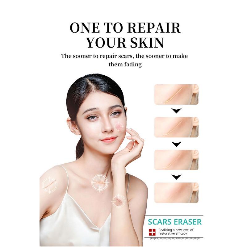 1PC After Burn Fading Skin Ointment