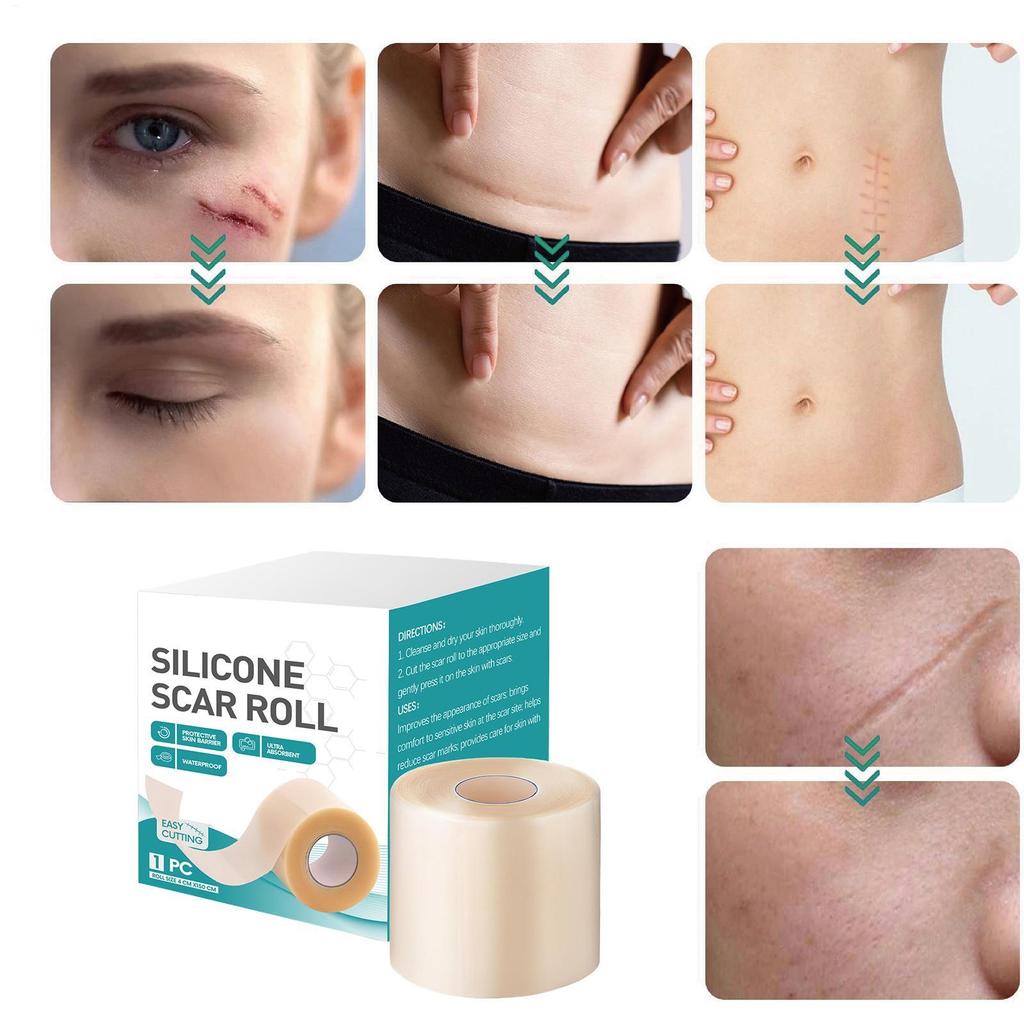 Silicone scar patch hydrocolloid roll self-adhesive ydrocolloid patch bandage highly absorbent for burn blister wound care