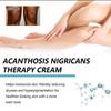 Spot Remover For Body,Spot Corrector Cream,- Underarm, Neck, Armpit, Knees, Elbows, Private Areas, Intimate Areas