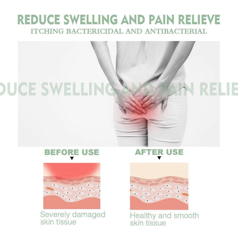 1-5x Anal Skin Repair Cream - Moisturizing Relief for Pain & Itching with Aloe Vera & Vitamin E