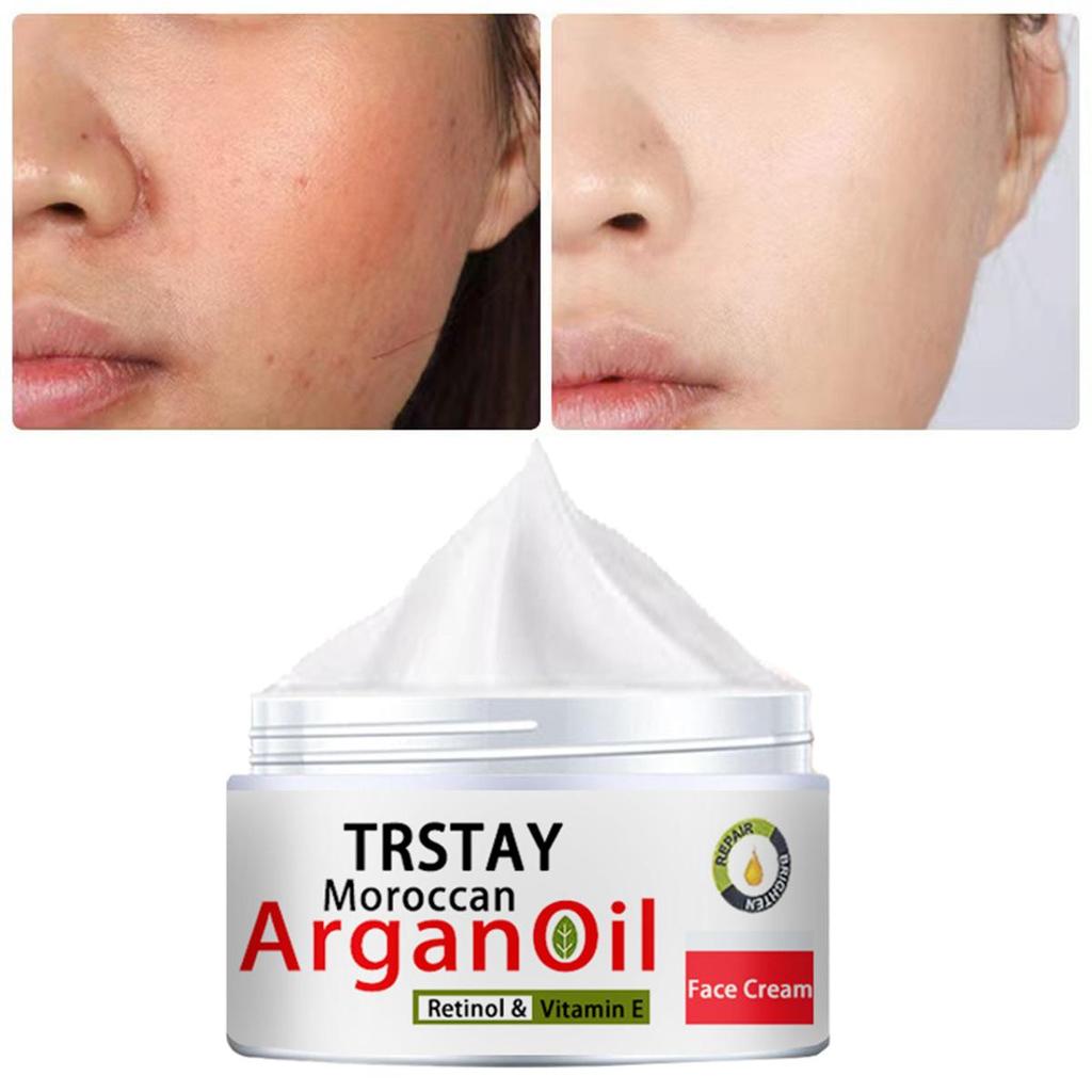 The Moisturizing Cream Is Gentle and Non-irritating, Hydrating and Nourishing the Skin, Leaving It Soft and Refined