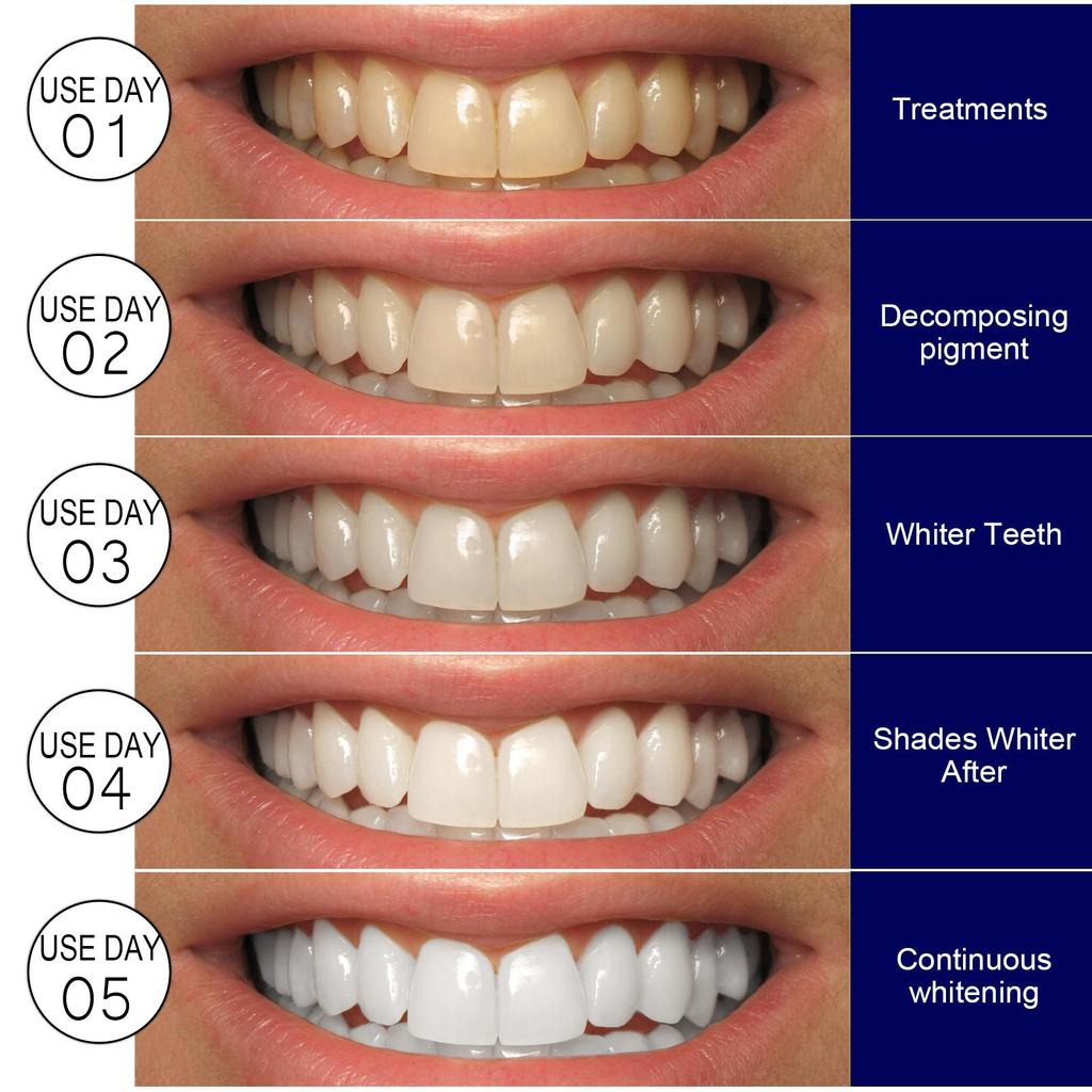 Brightening Teeth Strips, Gentle Stain Removal & Whitening, Daily Oral Care Cleansing Strips