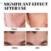 Anti-Wrinkle Cream for Men Mild Moisturizing Removing Wrinkles Firming Lifting Neck Fade Fine Lines Anti-Aging Facial Treatment