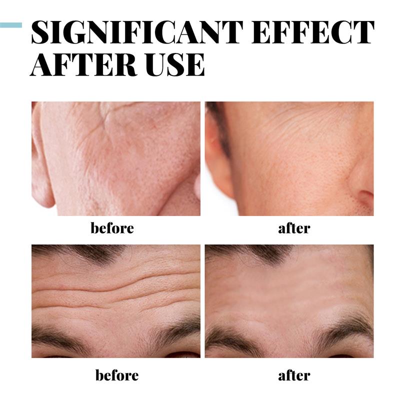 Anti-Wrinkle Cream for Men Mild Moisturizing Removing Wrinkles Firming Lifting Neck Fade Fine Lines Anti-Aging Facial Treatment
