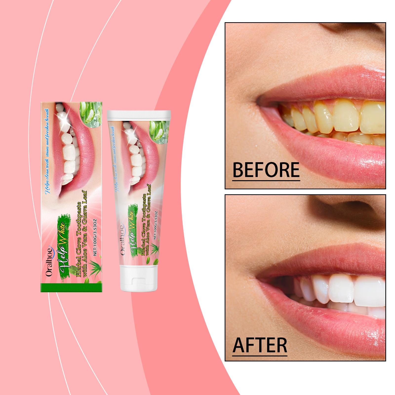 

Glow Fresh Breath Toothpaste Clean & Care Teeth Brighten & Remove Stains Oral Care Herbal Toothpaste