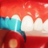 15 buc/50 buc matrice anterioară conturată dentară albastru transparent benzi anterioare din poliester grosime 0,05 mm materiale dentare