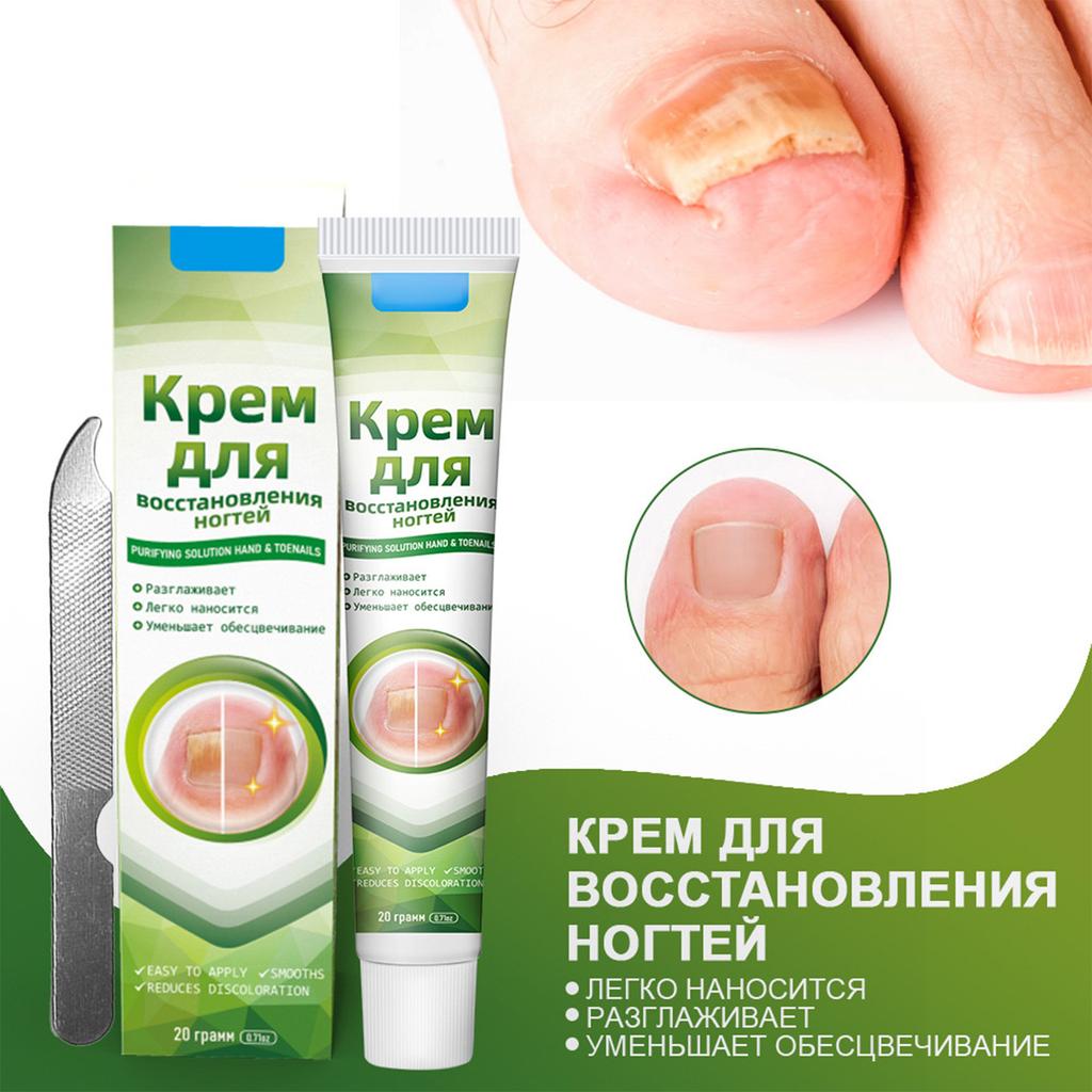 Plaster  Gray Nail Cream  New Bright Potassium Nail Cream  With File