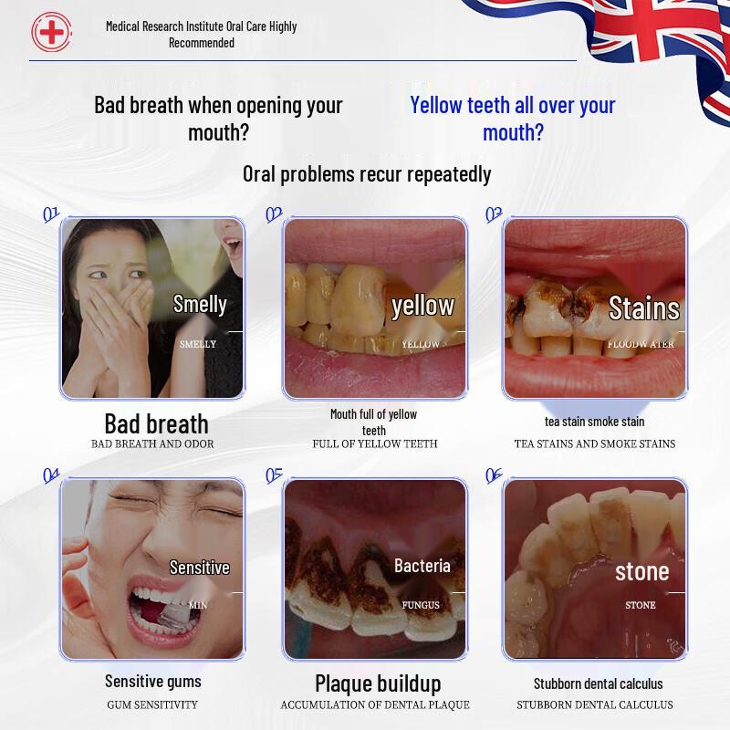 Wuyang Povidone-Iodine Antibacterial Mouthwash