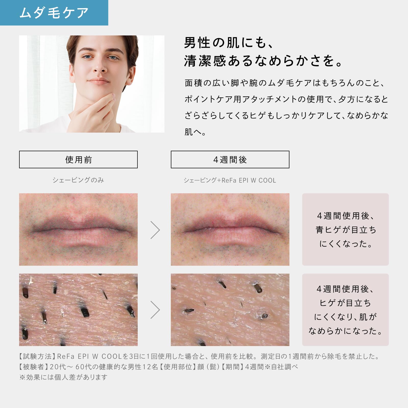 ReFa EPI （RE-BA） ReFa BEAUTECH EPI | PRODUCTS | ReFa | MTG Co., Ltd.