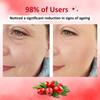INTIMIFY 0.3% Retinol Serum For Face, Dark Spots Reduction, Oil Control, Reduces Fine Lines & Wrinkles, For Men & Women 30 Ml