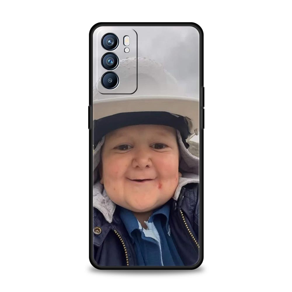 Funny Hasbulla Phone Case For Oppo Reno8 Reno7 Reno6 Pro A54 5G Find X6 X5 A53 A52 A9 A15 A95 A17 A16 A76 A74 A57 A31 Cover