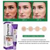 Freckle Whitening Cream Melasma Dark Spots Pigmentation Removal Product Fade Stain Melanin Fast Repair Brighten Korean Skin Car