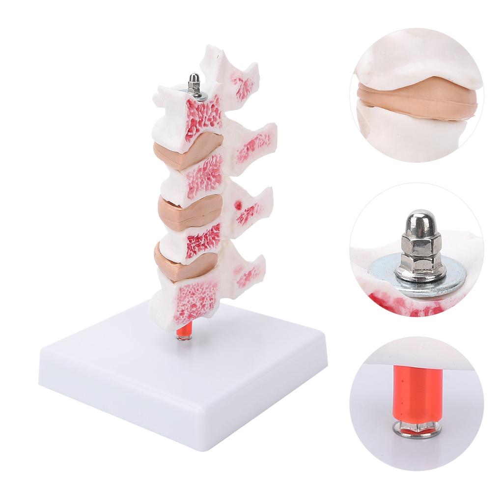 Professional Osteoporosis Model Human Anatomical Spine Model for Teaching Demonstration