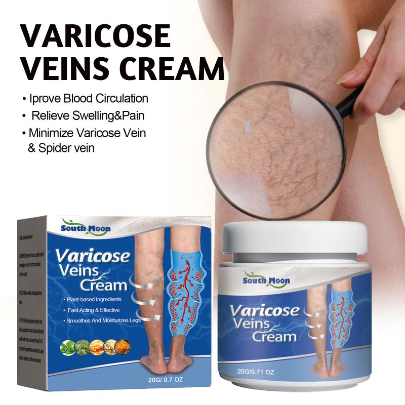 Treatment Creams Soothing Painness Eliminate Vasculitis Phlebitis Remove Spider Leg Angiitis Improvement Ointment