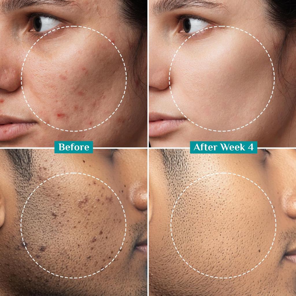 Pilgrim 2% Alpha Arbutin 3% Vitamin C Brightening Face Serum For Radiant Glow All Skin Types Pack Of 2 30 ml