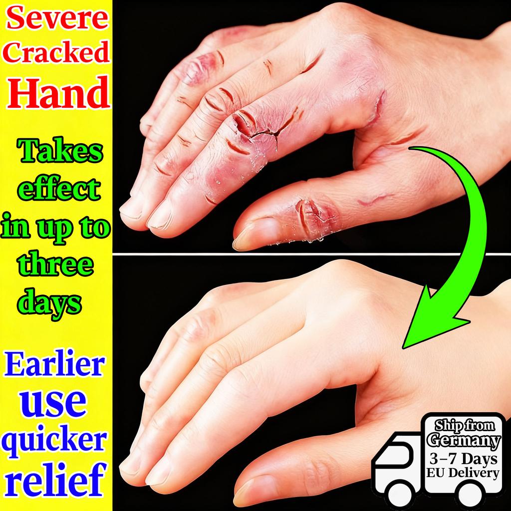 Lightweight Gel Cream for Dry & Cracked Hands Feet - Herbal Hydration